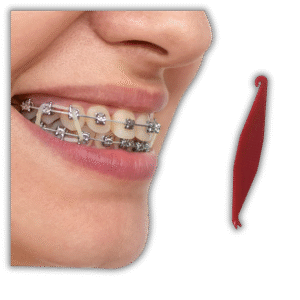 Best orthodontist in Newark CA