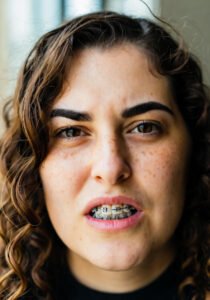 Orthodontist in Newark Fremont