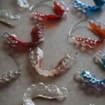 Retainer Types Fremont CA