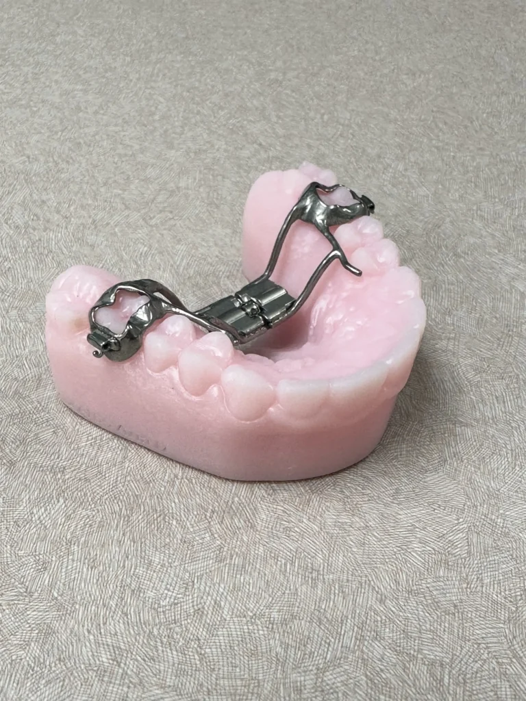 Palatal Expander in Fremont CA