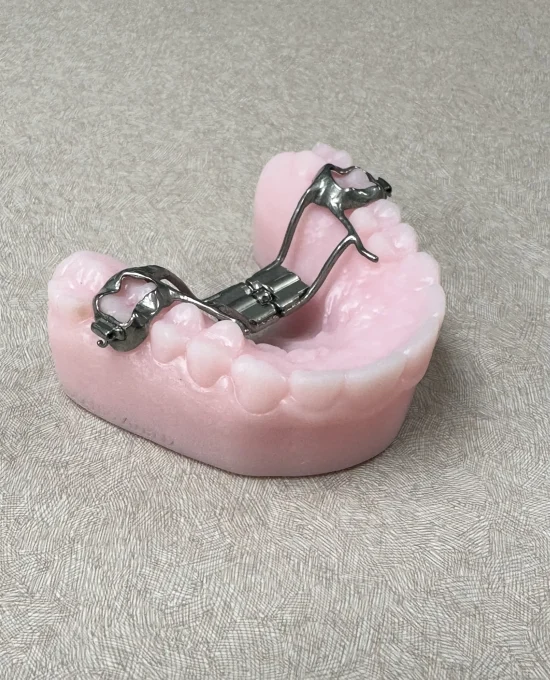 Palatal Expander in Fremont CA